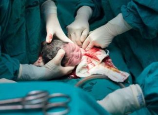 Projeto que permite cesárea por escolha da gestante promete debate acirrado na AL-BA