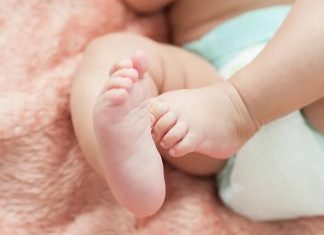 Nova varíola costuma ser mais agressiva em crianças, alerta infectopediatra