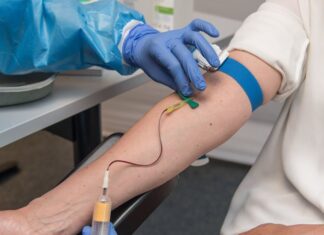 Exame de sangue que detecta Alzheimer chega ao Brasil