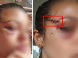 Advogada de PF atingida por Roberto Jefferson detalha efeitos de tiros disparados por ex-deputado