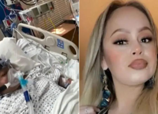 Mulher tem braços e pernas amputados após comer peixe mal passado