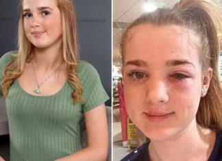 Adolescente quase fica cega por dica de beleza vista no TikTok; saiba detalhes