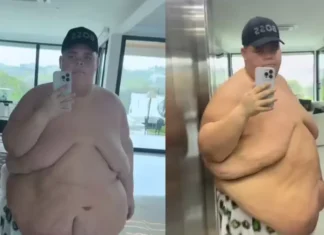 Após perder 75 kg, Gordão da XJ quer andar em elevador: ‘Já quebrei três