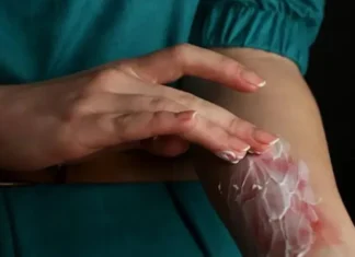 Mulher tem quase 60% do corpo queimado após ritual religioso na Bahia