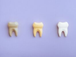 5 mitos e verdades sobre manchas nos dentes