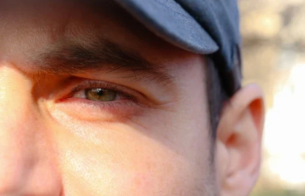 Por que tanta gente está raspando os cílios – e qual o perigo por trás disso