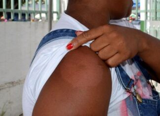 Janeiro Roxo reforça combate à hanseníase em Feira de Santana