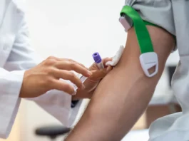 Alzheimer pode ser identificado por novo exame de sangue; entenda