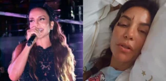 Após ser internada, Ivete Sangalo surge com rosto ferido e explica estado de saúde: ‘Caí com tudo’