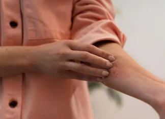 Não é coincidência: por que cicatrizes coçam ou doem antes da chuva