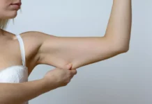 Nem pilates nem cardio: veja o exercício mais indicado para reduzir flacidez no braço