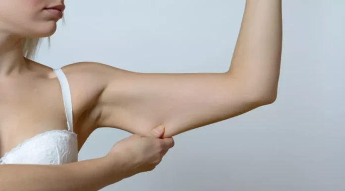 Nem pilates nem cardio: veja o exercício mais indicado para reduzir flacidez no braço