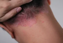 Coceira que não passa, pele seca e lesões no corpo: veja quando esses sinais merecem atenção