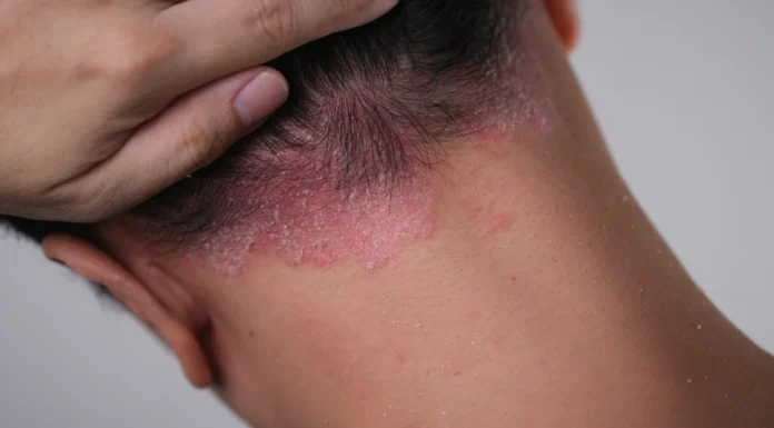 Coceira que não passa, pele seca e lesões no corpo: veja quando esses sinais merecem atenção