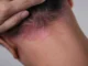 Coceira que não passa, pele seca e lesões no corpo: veja quando esses sinais merecem atenção